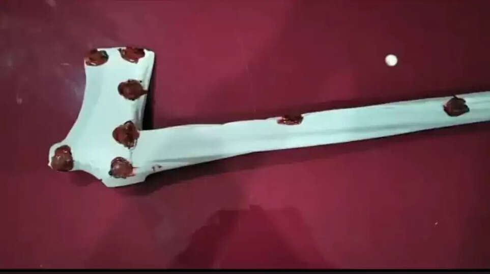 ​Domestic Violence Rewa