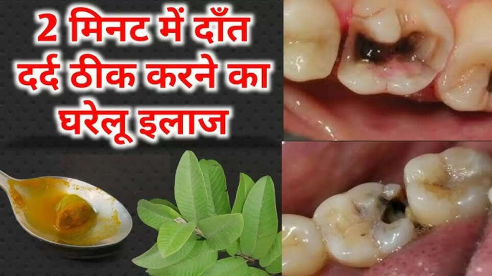 Dant Ka Kida Kaise Marein | Tooth Worm Home Remedies